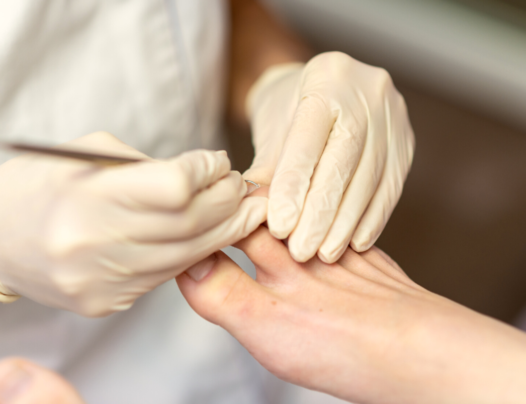 Medische pedicure